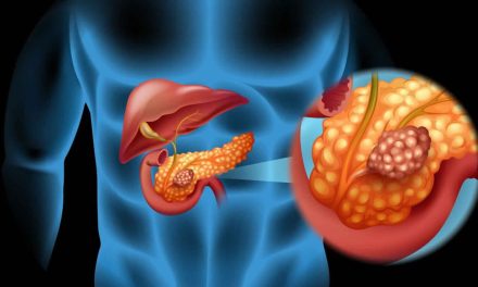 Vipoma, Tumor Langka yang Menyebabkan Diare Parah